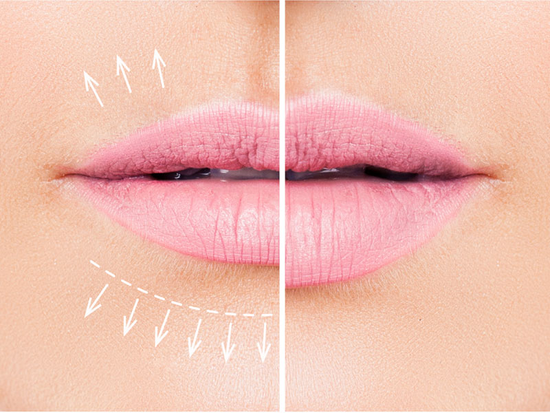 Conditions Laser Skin Care